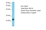 RAB11B Polyclonal Antibody