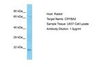 CRYBA2 Polyclonal Antibody