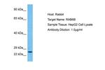 RAB6B Polyclonal Antibody