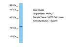 ANKRA2 Polyclonal Antibody