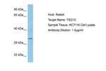 TSGA10 Polyclonal Antibody