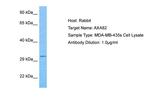 ANXA8L1 Polyclonal Antibody