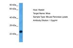 MRAS Polyclonal Antibody