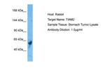 TIAM2 Polyclonal Antibody