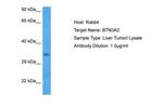 BTN3A2 Polyclonal Antibody