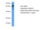 ZDHHC5 Polyclonal Antibody
