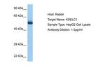 KDELC1 Polyclonal Antibody