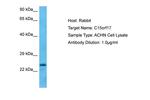FAM219B Polyclonal Antibody