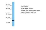 GHRH Polyclonal Antibody