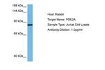 PDE2A Polyclonal Antibody