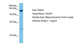 C4ORF41 Polyclonal Antibody