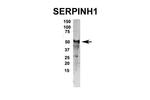 SERPINH1 Polyclonal Antibody