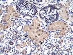 SNAPC2 Polyclonal Antibody