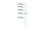 SNAPC2 Antibody in Western Blot (WB)