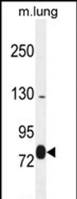 EXOC8 Antibody in Western Blot (WB)