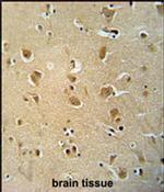 WWC3 Antibody in Immunohistochemistry (IHC)