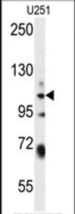 WWC3 Antibody in Western Blot (WB)