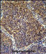 CD2BP2 Antibody in Immunohistochemistry (IHC)
