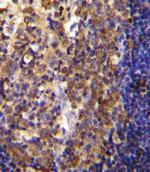 His6-DEP-1 Antibody in Immunohistochemistry (IHC)