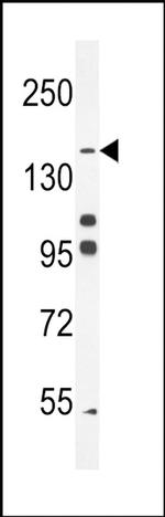 His6-DEP-1 Antibody in Western Blot (WB)