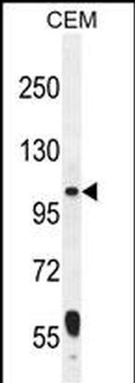 LARS2 Antibody in Western Blot (WB)