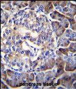 HIP1R Antibody in Immunohistochemistry (IHC)