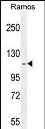 HIP1R Antibody in Western Blot (WB)