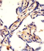 CAD Antibody in Immunohistochemistry (IHC)