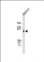 CAD Antibody in Western Blot (WB)