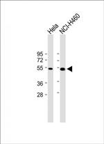 FGL2 Antibody in Western Blot (WB)