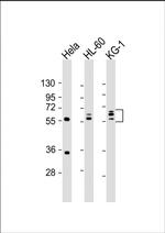 FGL2 Antibody in Western Blot (WB)