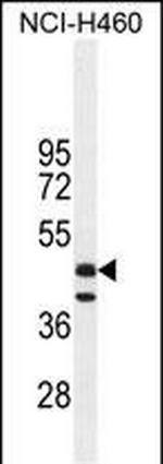 FGL2 Antibody in Western Blot (WB)