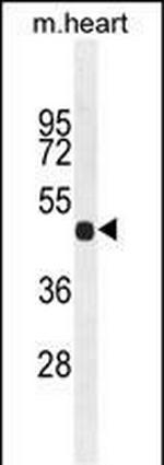 FGL2 Antibody in Western Blot (WB)