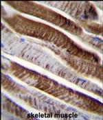 ETFA Antibody in Immunohistochemistry (IHC)