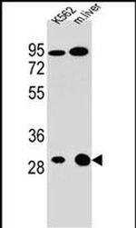 ETFA Antibody in Western Blot (WB)