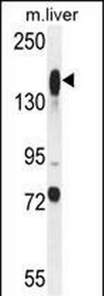 ASXL1 Antibody in Western Blot (WB)