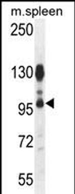 CENTB1 Antibody in Western Blot (WB)