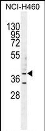 B3GALT5 Antibody in Western Blot (WB)