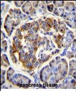 C12orf29 Antibody in Immunohistochemistry (IHC)