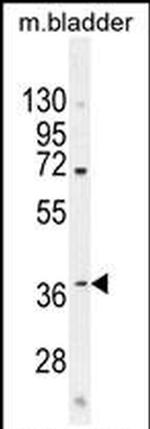 C12orf29 Antibody in Western Blot (WB)