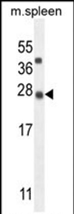 KIAA1143 Antibody in Western Blot (WB)
