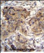 TTC9C Antibody in Immunohistochemistry (IHC)