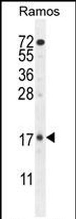 TTC9C Antibody in Western Blot (WB)