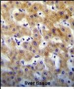 KRTCAP2 Antibody in Immunohistochemistry (IHC)