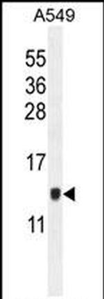 KRTCAP2 Antibody in Western Blot (WB)