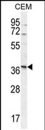 NXPH4 Antibody in Western Blot (WB)
