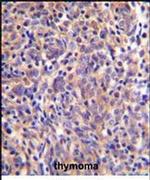 Themis Antibody in Immunohistochemistry (IHC)