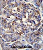 PPP1R37 Polyclonal Antibody