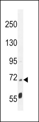PPP1R37 Antibody in Western Blot (WB)