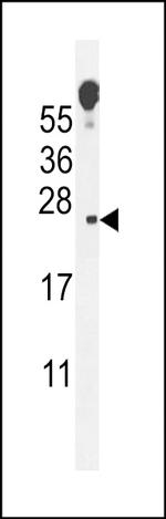 Vopp1 Polyclonal Antibody